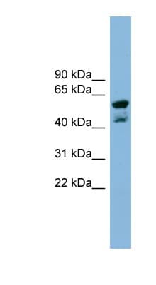 Polyclonal Rabbit anti-Human PME-1 / PPME1 Antibody (N-Terminus, WB)