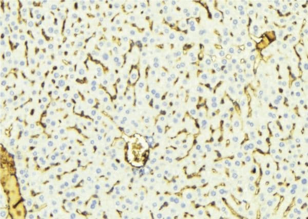 CYP8B1 Antibody