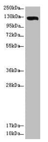 Polyclonal Rabbit anti-Human USP28 Antibody (IHC, WB)