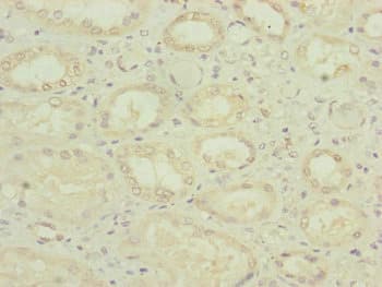 Polyclonal Rabbit anti-Human POP4 Antibody (IHC)
