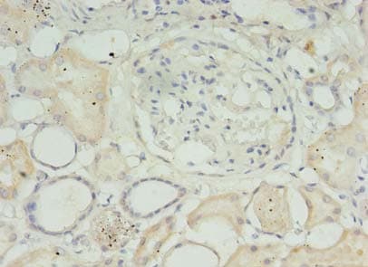 MED30 Antibody