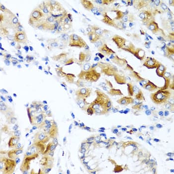 CCL21 / SLC Antibody