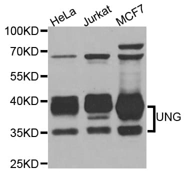 UNG / Uracil DNA Glycosylase Antibody