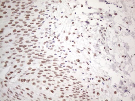 TP53BP1 / 53BP1 Antibody (aa1-300, clone OTI5E1)