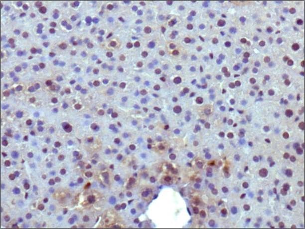 Polyclonal Rabbit anti-Human PPARG / PPAR Gamma Antibody (aa20-120, IHC, WB)