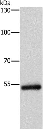 CYP2B6 Antibody