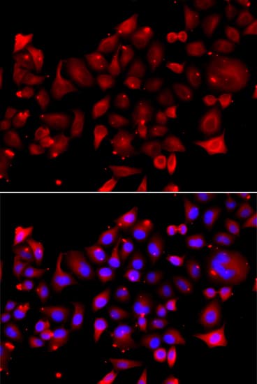 PathPlus™ Polyclonal Rabbit anti-Human RRM2B / P53R2 Antibody (IHC, IF, WB)