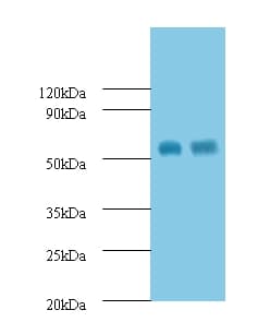 MMP12 Antibody