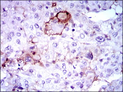 LPA / Lipoprotein a Antibody (clone 4H1)