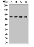 IHC-plus™ Polyclonal Rabbit anti-Human CDH11 / Cadherin 11 Antibody (IHC, WB)