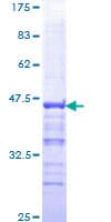 Human PYGO2 / Pygopus 2 Protein (Recombinant GST, N-terminus)