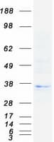 Human HLA-DOB Protein (Recombinant Myc-DDK (Flag))