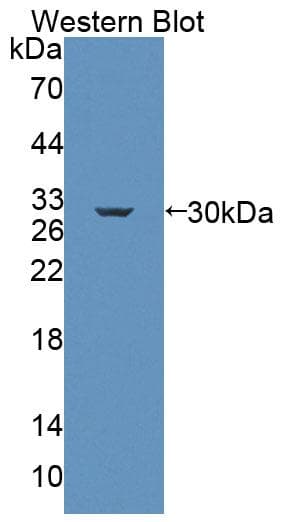 ABCC6 / MRP6 Antibody
