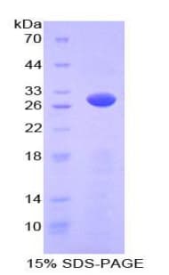 Mouse PRKAG2 / AMPK Gamma 2 Protein (Recombinant His-T7)