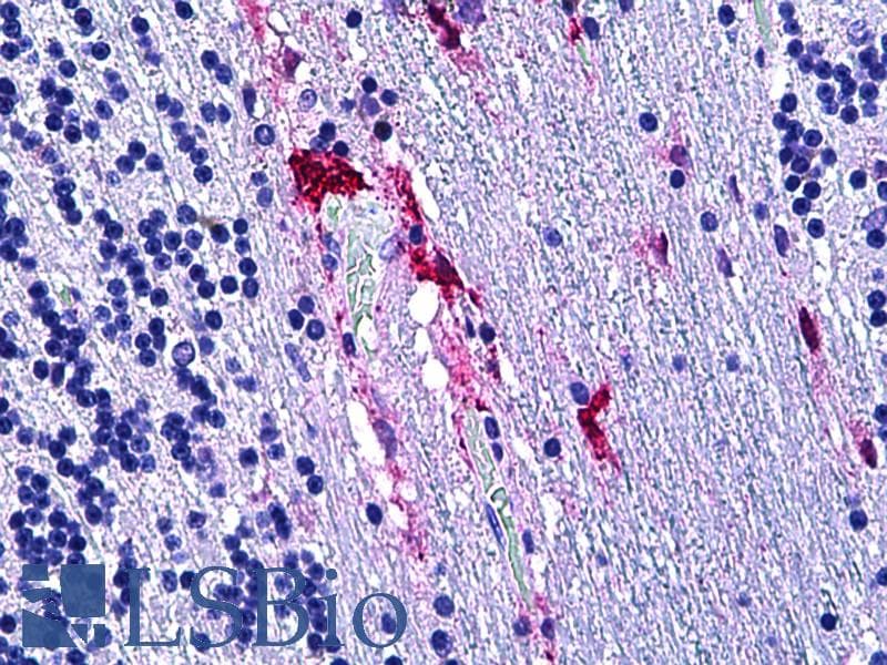 IHC-plus™ PRKD2 / PKD2 Antibody (aa829-878)