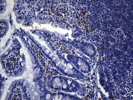 MCAM / CD146 Antibody (clone UMAB155)