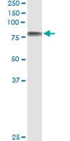 ICAM-1 / CD54 Antibody (clone 3H8-2G6)