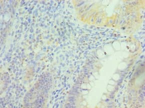 PRDX5 / Peroxiredoxin 5 Antibody (aa53-214)