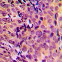 MRPL17 Antibody (C-Terminus)