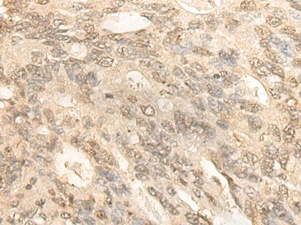 BCAS3 Antibody