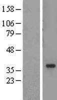 TADA2L / ADA2A Protein (Over-Expression Lysate Myc-DDK (Flag))