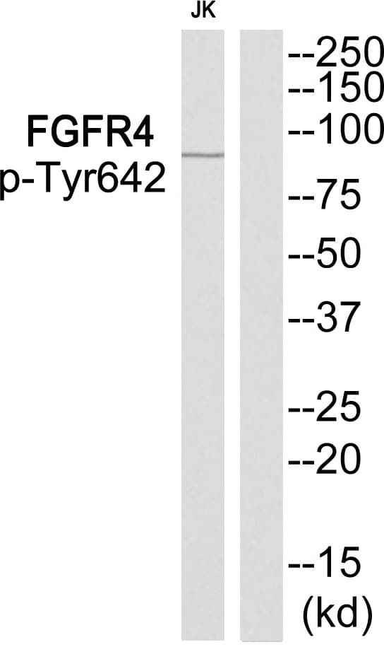 Polyclonal Rabbit anti-Human FGFR4 Antibody (phospho-Tyr642, WB)