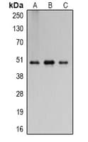 Polyclonal Rabbit anti-Human FLOT2 / Flotillin 2 Antibody (IHC, WB)