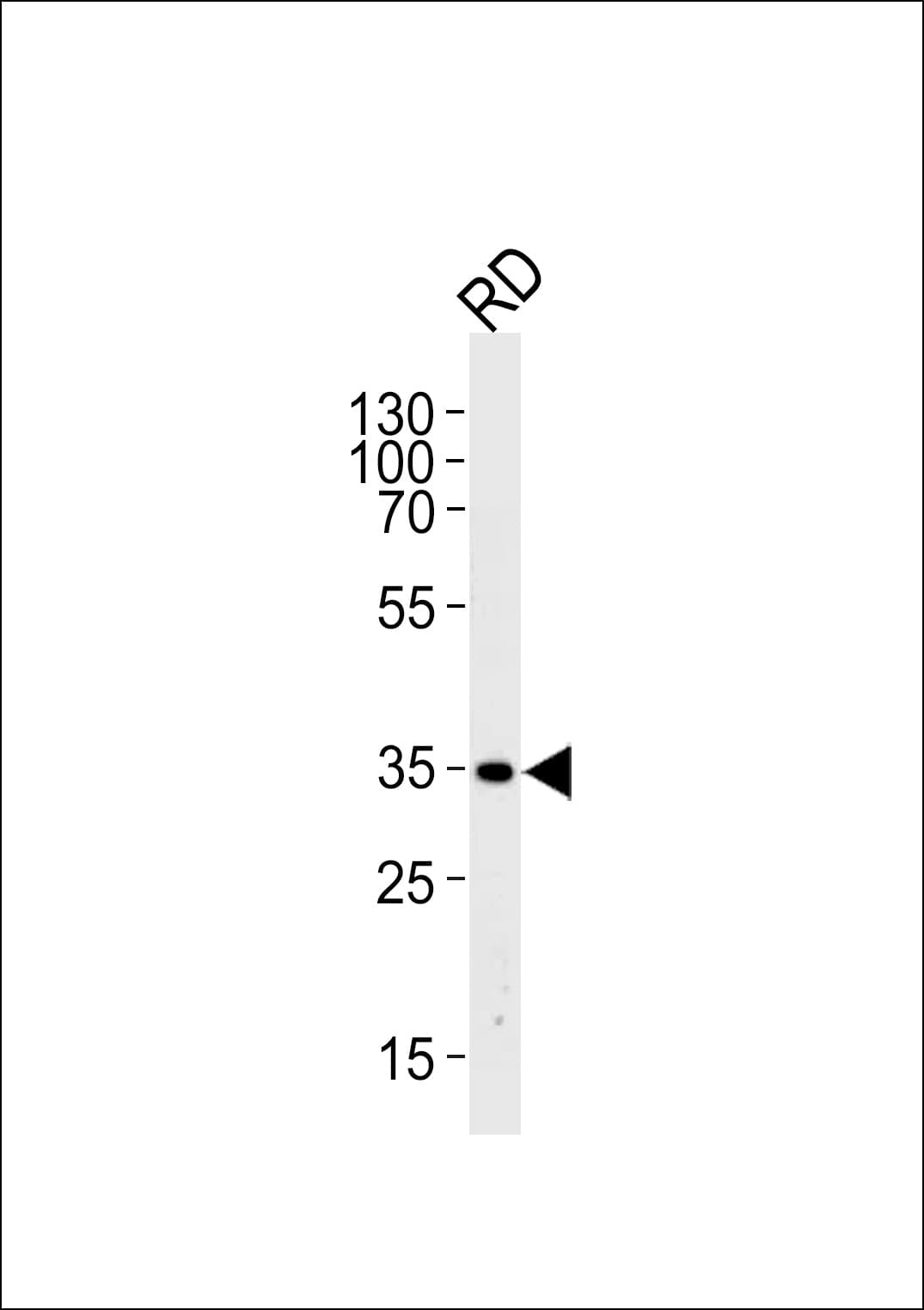 EDA / Ectodysplasin A Antibody (aa47-76)