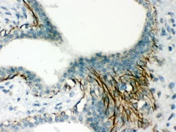 ACTA1 / Skeletal Muscle Actin Antibody