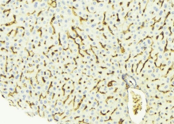 ECI2 / PECI Antibody