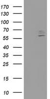 CYP2J2 Antibody (clone OTI5C9)