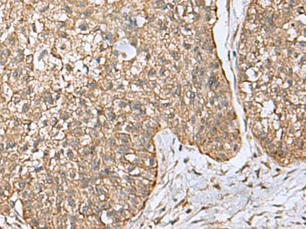 Polyclonal Rabbit anti-Human EIF4A2 Antibody (IHC)