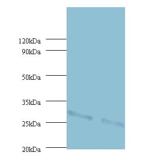 IHC-plus™ UQCRFS1 Antibody