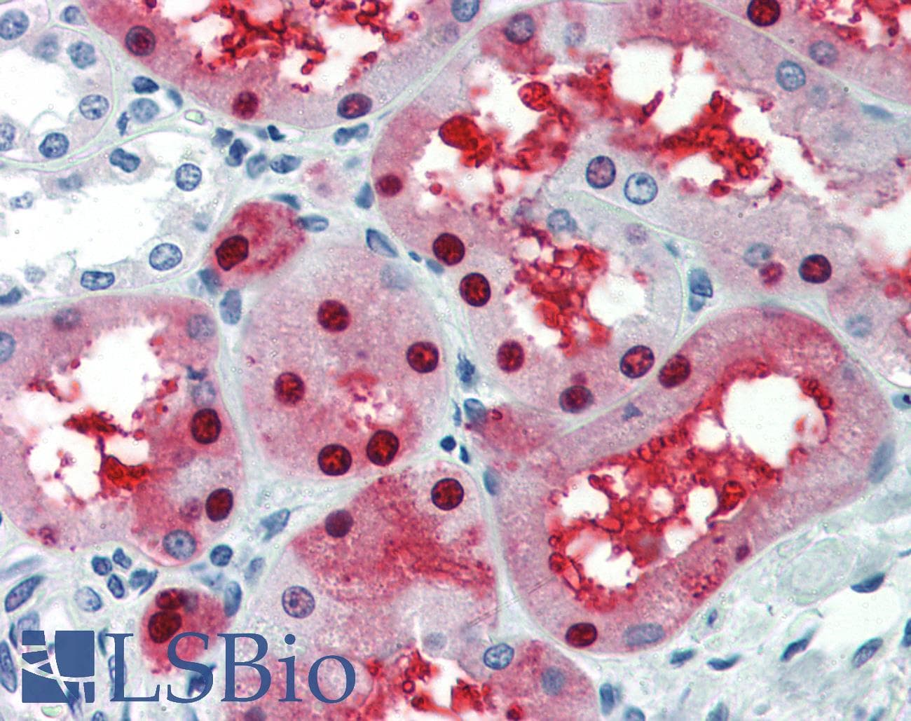 PathPlus™ GATA3 Antibody (aa36-85)