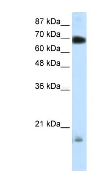 Polyclonal Rabbit anti-Human HT2A / TRIM32 Antibody (aa549-598, IHC, WB)