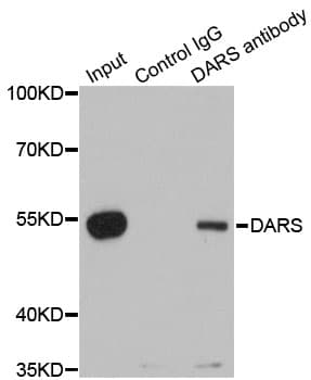 DARS Antibody
