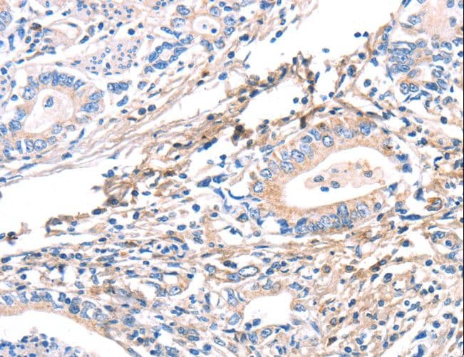 TWF2 / PTK9L Antibody