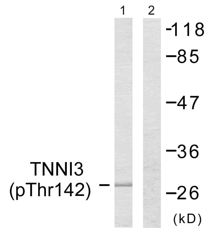TNNI3 / Cardiac Troponin I Antibody (phospho-Thr142)