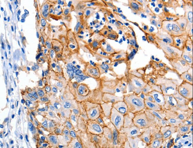 Polyclonal Rabbit anti-Human CLDN1 / Claudin 1 Antibody (IHC, WB)