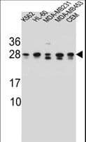 RAB3D Antibody (aa185-212)