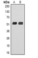 CA9 / Carbonic Anhydrase IX Antibody