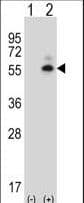 CAMK2D / CaMKII Delta Antibody (aa221-250)