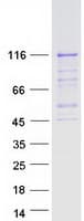 Human PMS2 Protein (Recombinant Myc-DDK (Flag))