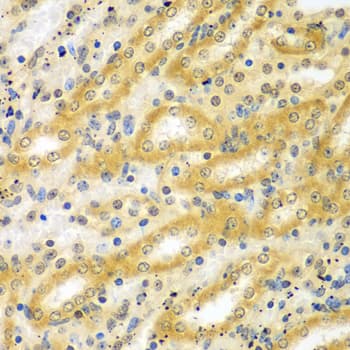 ADCK3 / CABC1 Antibody