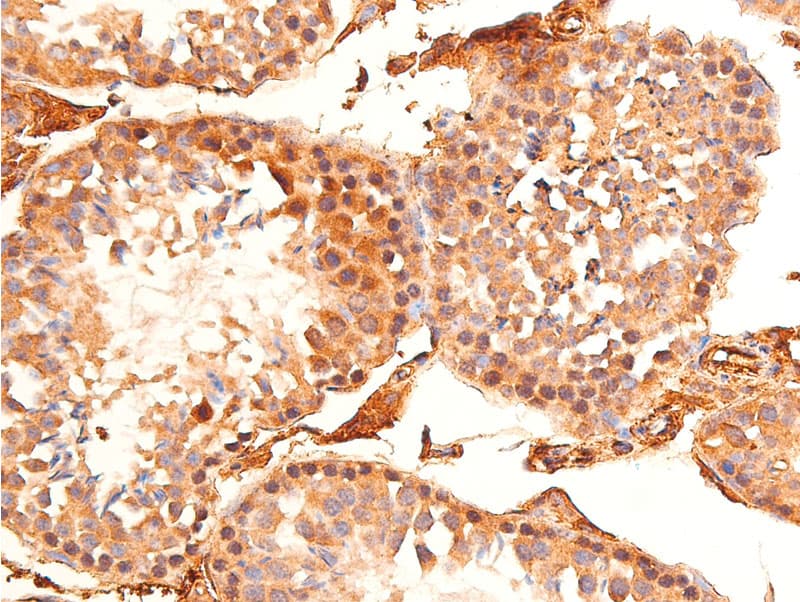 Polyclonal Rabbit anti-Human CHEK1 / CHK1 Antibody (phospho-Ser296, IHC, IF, WB)