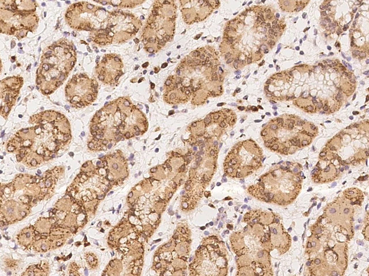 CLASP1 Antibody