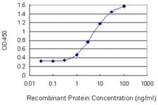 GALK1 / GK1 Antibody (clone 2E9)