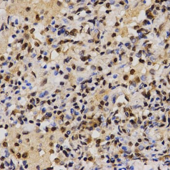 IHC-plus™ Polyclonal Rabbit anti-Human SKIV2L2 Antibody (IHC, WB)