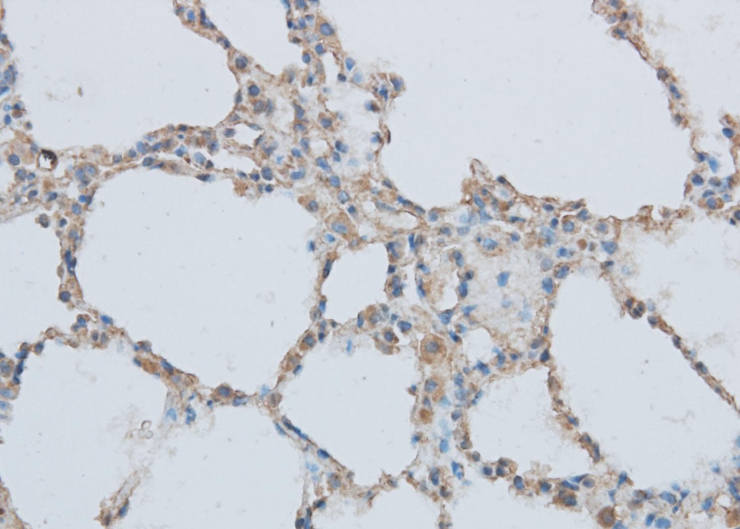 MMP1 Antibody