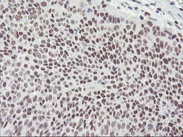 RNF113B Antibody (clone OTI1B10)